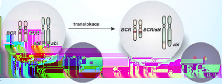 Obrázek 15: Fluorescenční in situ hybridizace detekce amplifikace genu myc Obrázek 16: Fluorescenční in situ hybridizace detekce translokace BCR/abl u chronické myeloidní leukémie (obr. 16). 7.