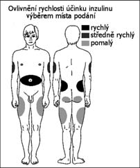 před aplikací), zavřít víčko do původní polohy, maximálně vydechnout, vložit náustek do úst mezi zuby a stisknout rty tak, aby nebyly zakryty průduchy na náustku, inhalovat ve vodorovné poloze, silně