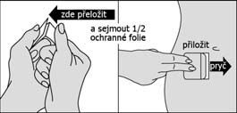 gázou vlhčenou olejem; regenerační masti při péči o prsa u kojících matek aplikovat na bradavky po každém kojení, při ošetřování kojenců aplikovat při každé výměně plen; nepoužívat při změně vzhledu,