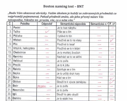 Neurologicky a kognitivně orientován zcela v čase, částečně v prostoru (spíše však anomie), dcera i vnoučata ví jména i dat.