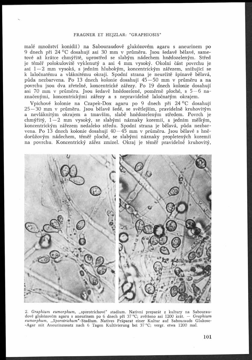 FRAGNER ET HEJZLAR: GRAPHIOSIS malé množství konidií) na Sabouraudově glukózovém agaru s aneurinem po 9 dnech při 24 C dosahují asi 30 mm v průměru.