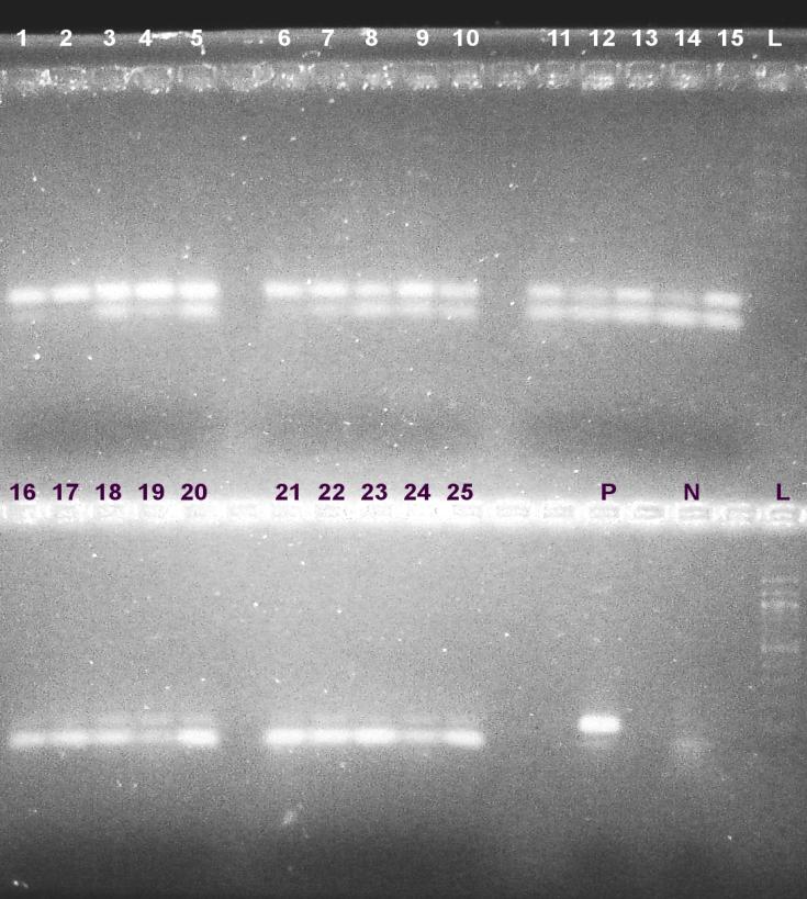 Ověření kvality izolované DNA kmene Lactobacillus delbrueckii CCM 7190 T s využitím magnetických nosičů pomocí polymerázové řetězové reakce s primery specifickými pro Lactobacillus delbrueckii (PPP