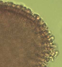 Obr. XIII: Geranium phaeum, klavátní zrno Obr. XIV: Fagus sylvatica, perforátní zrno Obr.