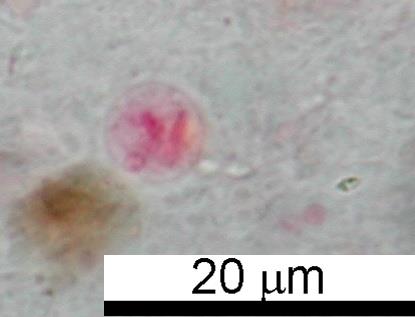 cysta ndolimax nana, kvasinky cysta ntamoeba hartmanni VZORK D: cysty ndolimax nana, četnost A, barveno hematoxylinem Cysty ndolimax nana neuvedla pouze jedna laboratoř, třikrát se vyskytl navíc