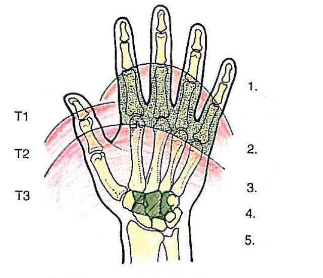 Obr. 7: Svaly ruky střední skupina mm. interossei (NETTER 2003) Obr.
