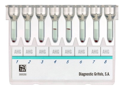 4.1.3.1. DG Gel ABO/Rh (2D) Obrázek č.9 DG Gel karta: konfigurace A-B-AB-DVI- -DVI+ -ctl.-n/a1 N/B (firma Grifols) Karta DG Gel AB0/Rh(2D) umožňuje kompletní vyšetření krevní skupiny AB0/Rh, tj.