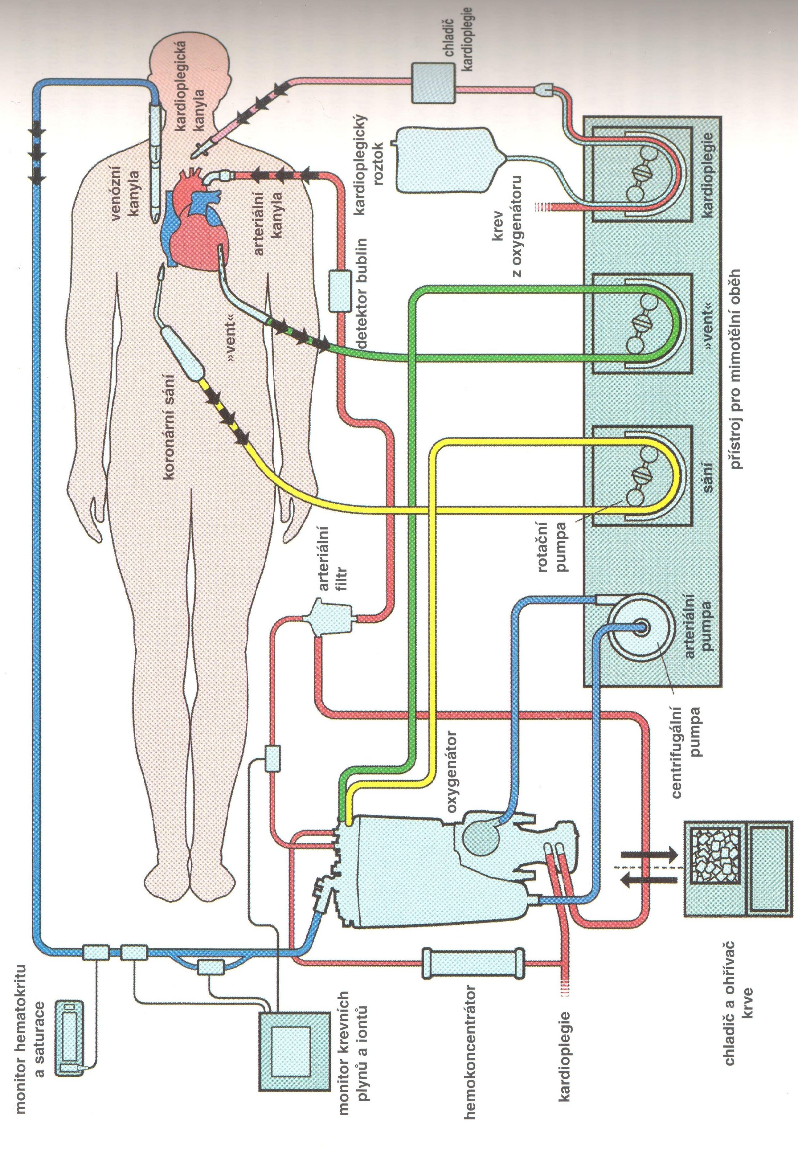 Obr. 19 Schéma zapojení mimotělního oběhu