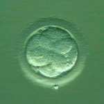 Embryotransfer Přenos embryí do dělohy pacientky, tzv. embryotransfer, se provádí ambulantně. Tenkou kanylou se do dělohy aplikují dvě nebo tři embrya.