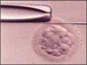 Metoda ICSI AH (asistovaný hatching) Aby se vajíčko mohlo uhnízdit v děloze, musí opustit ochranný obal, který jej chránil před vícečetným průnikem spermií.