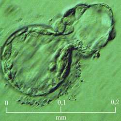 120 hodin po oplození 130 hodin po oplození Nejvyšší stádium časného embryonálního Blastocysta opouští obal, který embryo vývoje. po celou dobu vývoje obklopoval. Tento proces se nazývá hatching.