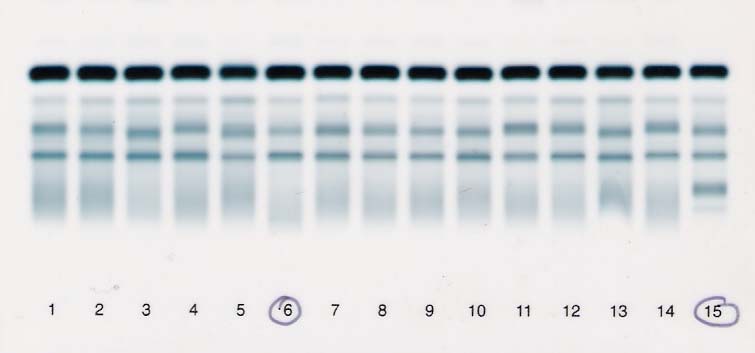 Hydragel Protein ELFO