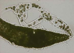 Microcystis M. aeruginosa M.