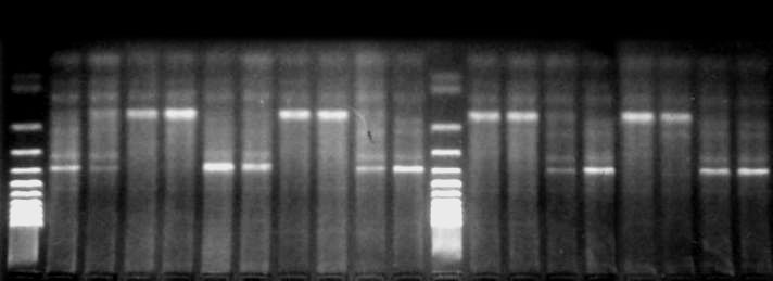 Pro PCR reakci bylo chemické složení následující: 60 ng templátové DNA, 0,24 µm primeru, 1x PCR pufr, 2,5 mm MgCl 2, 0,2 mm dntp, 1,5U Taq polymerázy (Fermentas, Litva).
