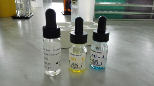 Reciprocita při Stanovení AB0 skupiny vyšetření AB0 antigenů na erys (aglutinogeny) vyšetření AB0 protilátek v séru/plazmě (aglutininy) solný test/ přímá aglutinace/ laboratorní teplota cca 20 C do 4.