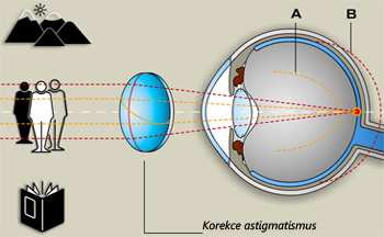 9.1.5. Korekce astigmatismu Základním požadavkem je vždy optimální korekce sférické složky, od které se pak odvíjí korekce astigmatismu.