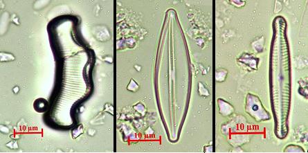 5. 6. 7. 8. 9. 10. 1. Eunotia bilunaris 2. Pinnularia gibba 3. Pinnularia rupestris 4. Surirella sp. 5.