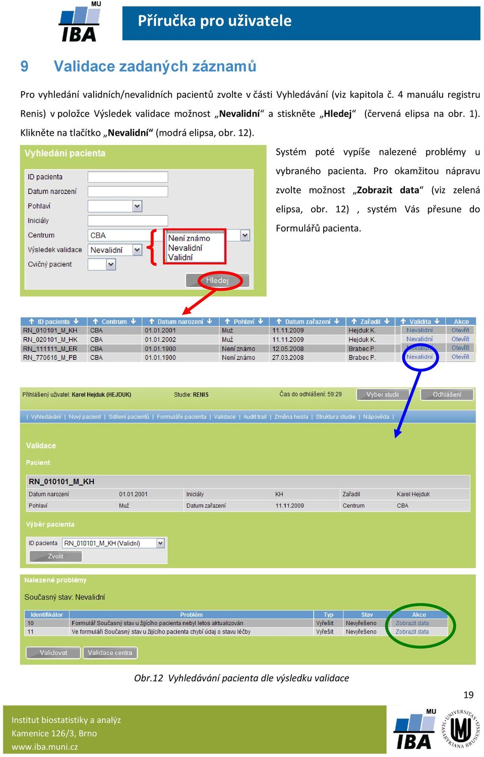 Klikněte na tlačítko Nevalidní (modrá elipsa, obr. 12). Systém poté vypíše nalezené problémy u vybraného pacienta.