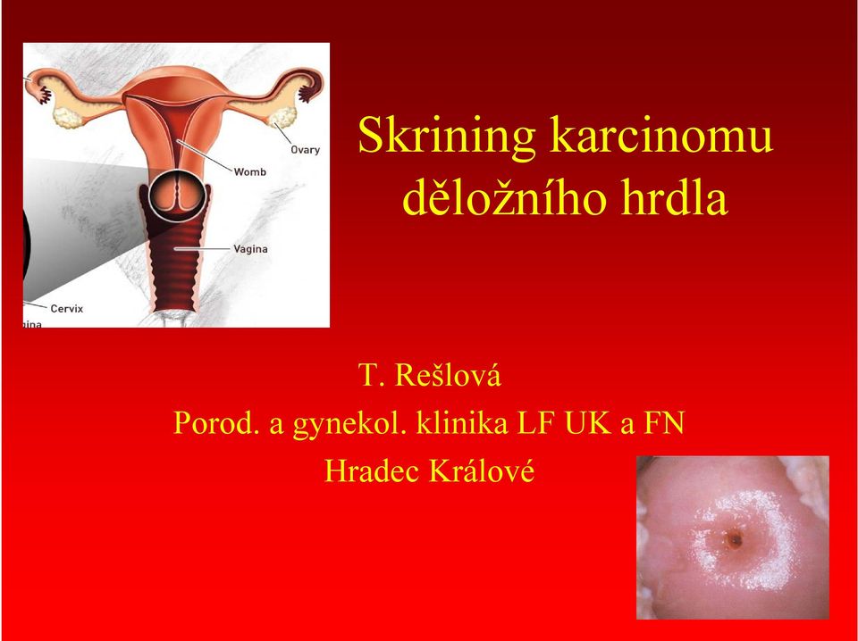 Rešlová Porod. a gynekol.