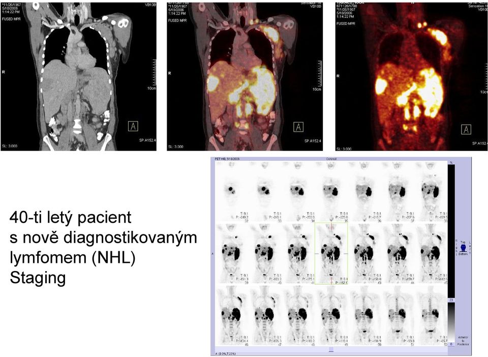 diagnostikovaným