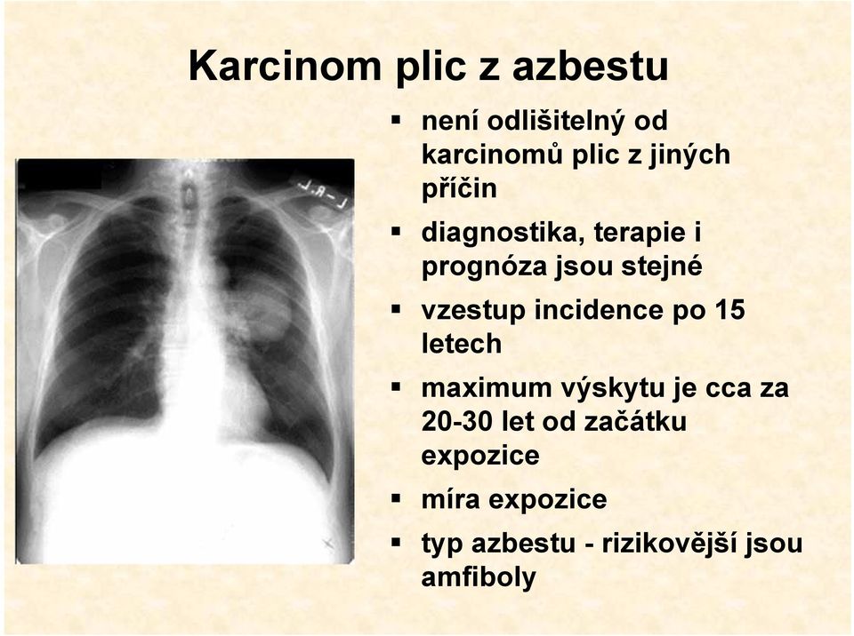 vzestup incidence po 15 letech maximum výskytu je cca za 20-30