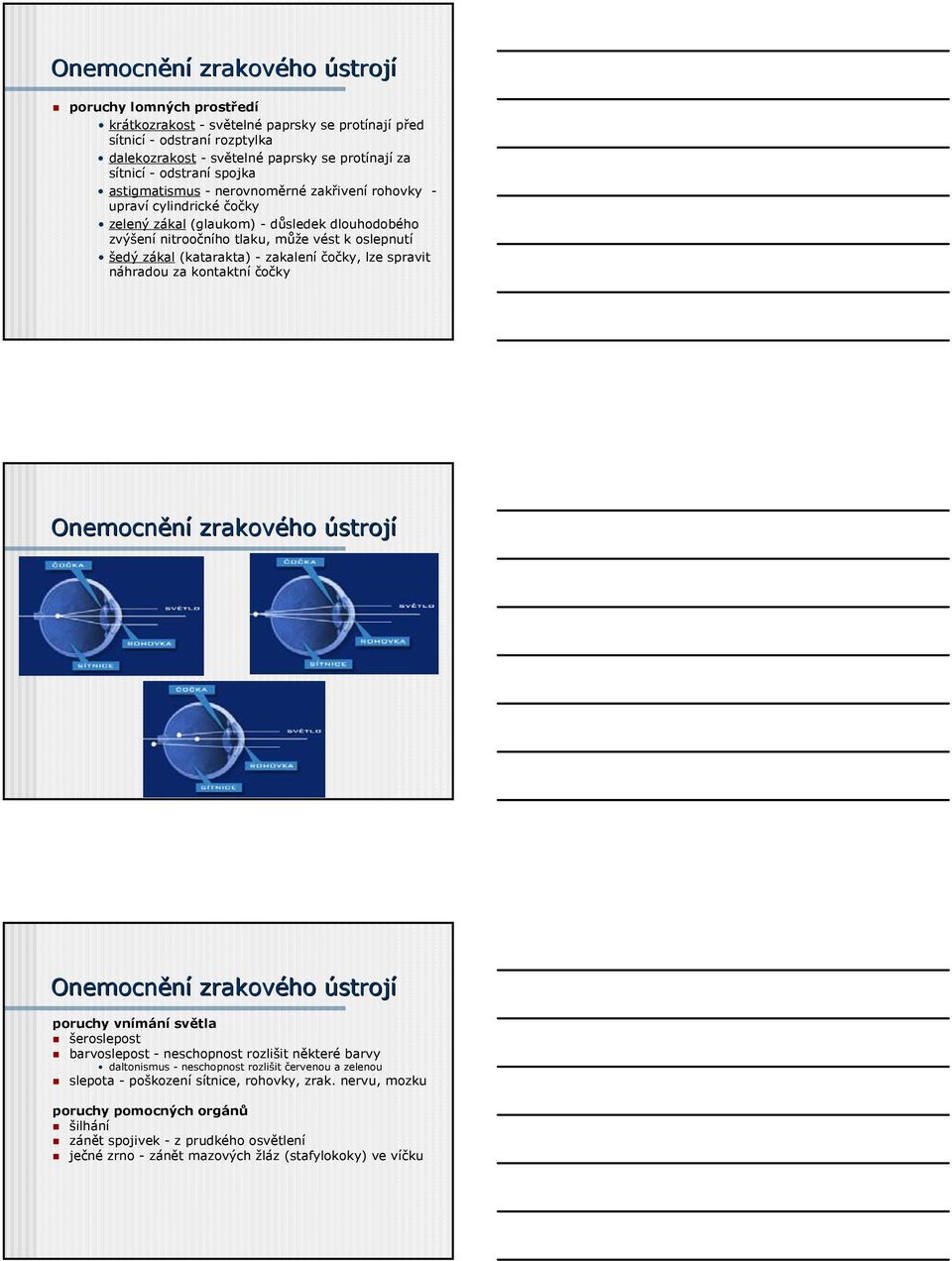 (katarakta) - zakalení čočky, lze spravit náhradou za kontaktní čočky Onemocnění zrakového ústrojí Onemocnění zrakového ústrojí poruchy vnímání světla šeroslepost barvoslepost - neschopnost rozlišit