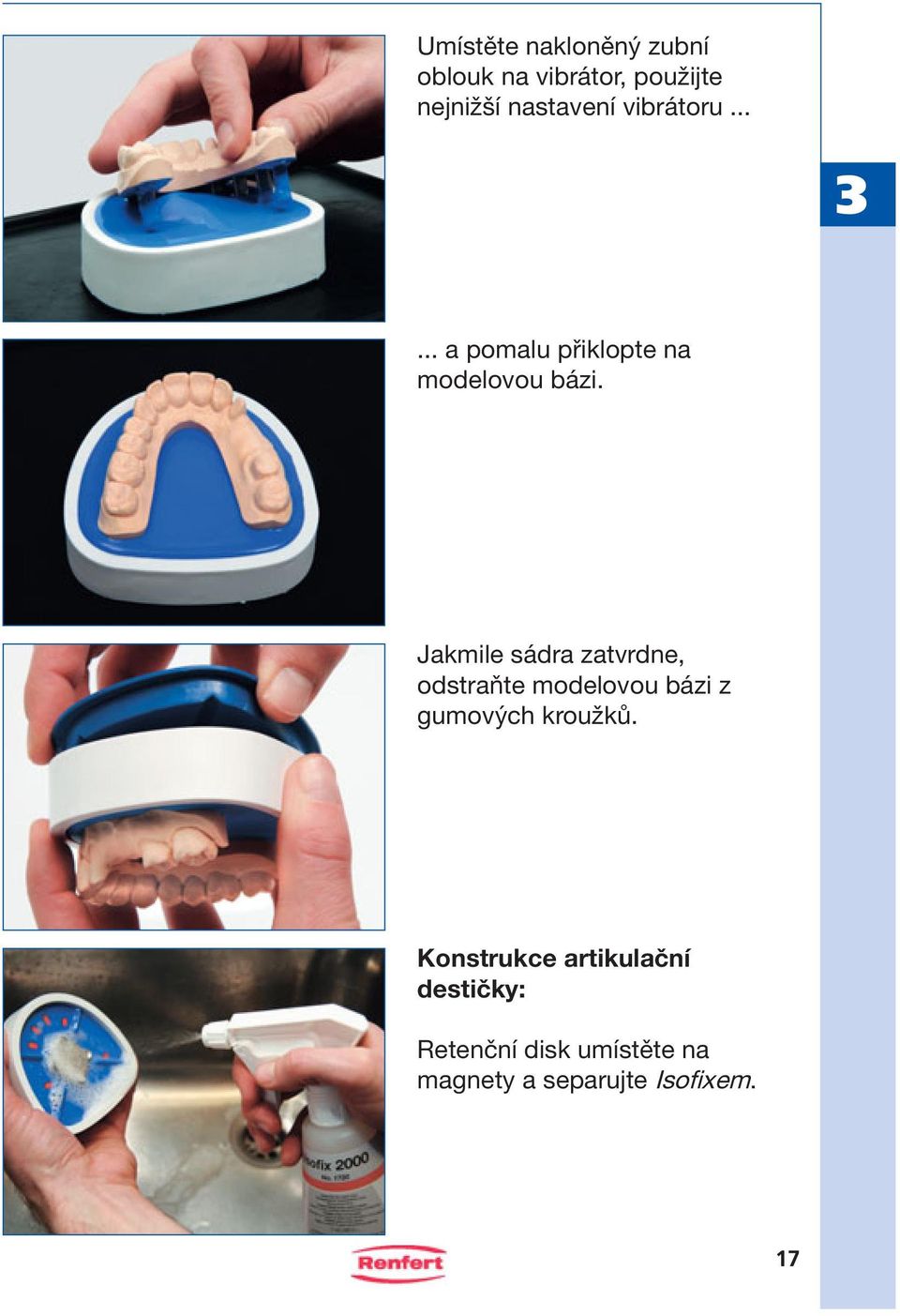 Jakmile sádra zatvrdne, odstraňte modelovou bázi z gumových kroužků.