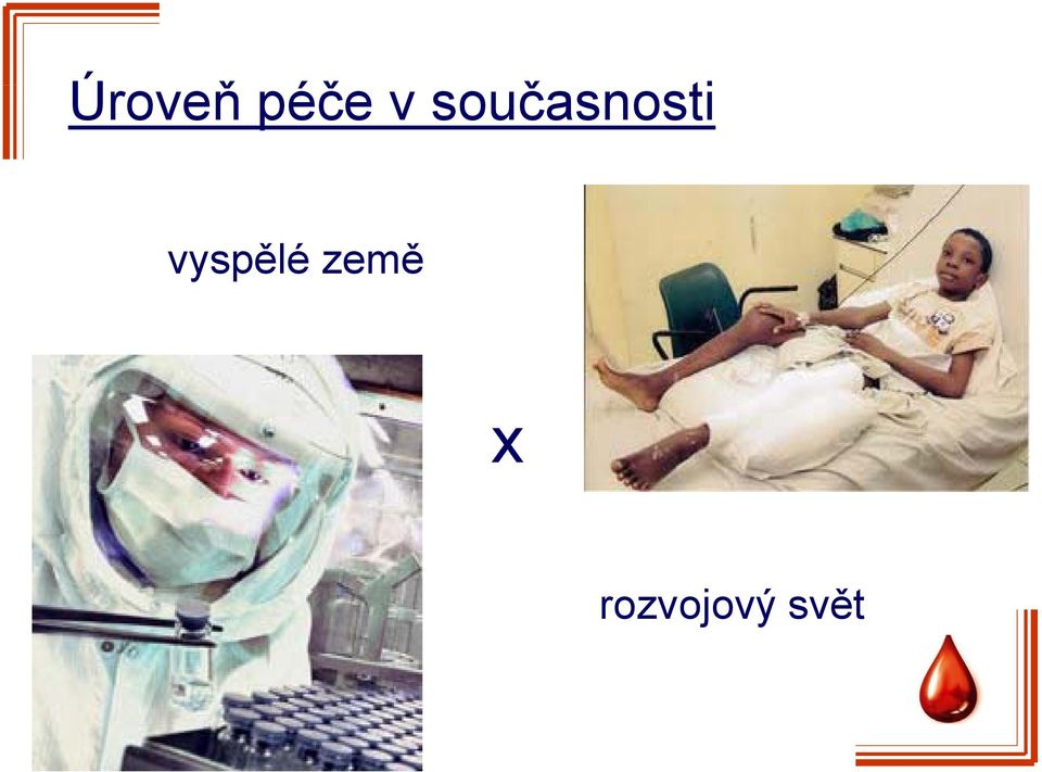 vyspělé země x