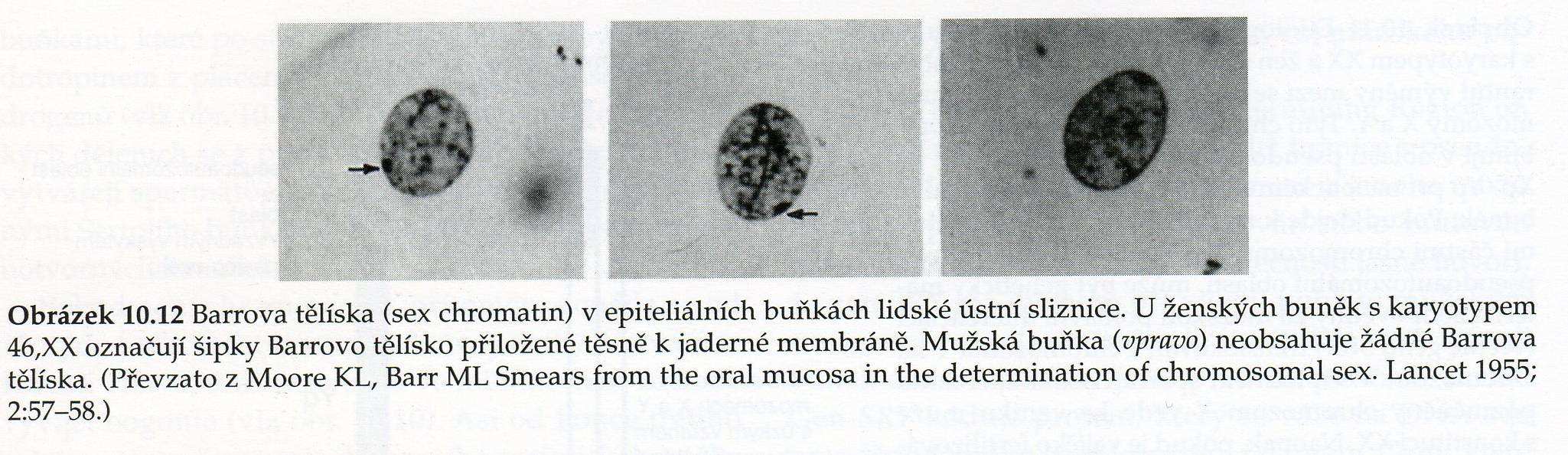 CHROMOSOM X normální ženský karyotyp 2 chromosomy X normální mužský karyotyp 1 chromosom X autosomy každý gen přítomen ve 2 kopiích, odchylky mohou vést k abnormálnímu fenotypu, v některých případech