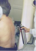 Na obrázku je tzv. sněžení, speciální metoda používaná při léčbě akné, alopecií a při rehabilitacích. 2.