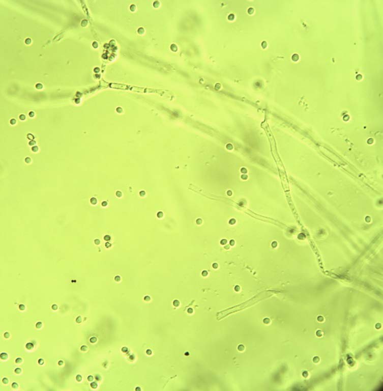 Beauveria bassiana teleomorph: Cordyceps parazituje na různých