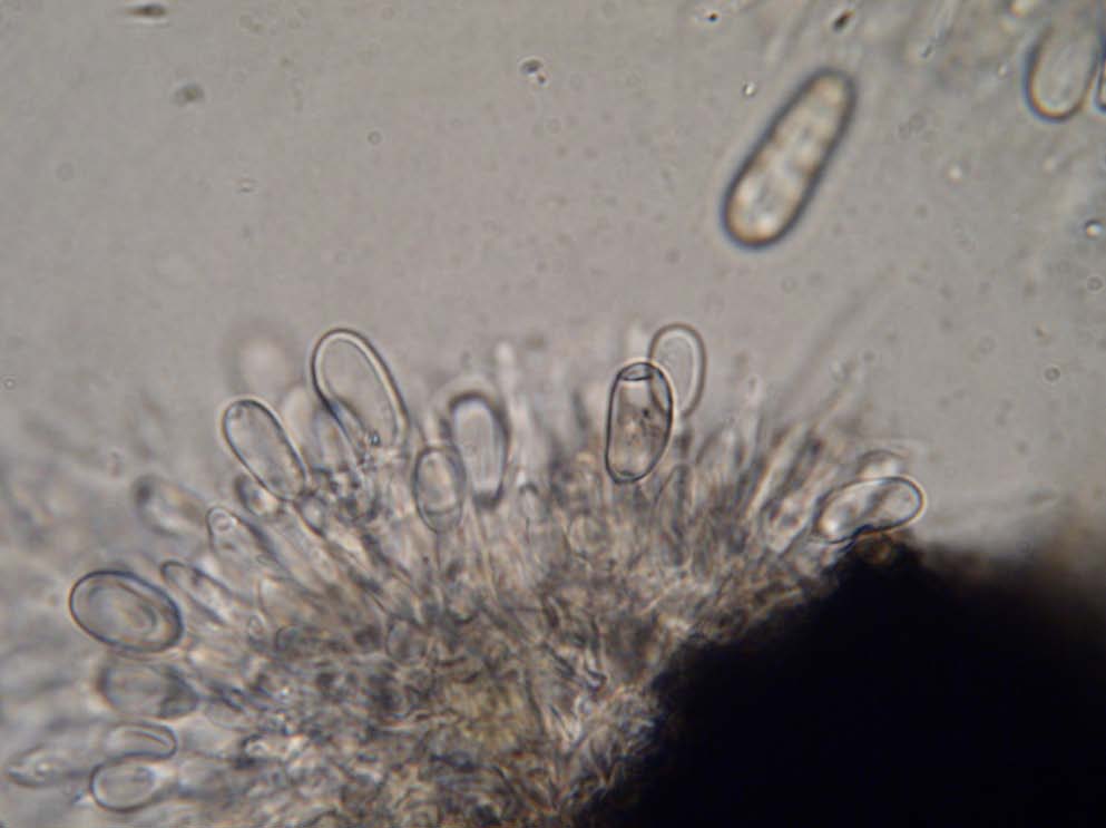 Sphaeropsis sapinea kultura mycelium zpočátku bílé, později tmavě šedé, konidiomata jednotlivé nebo nahloučené, kulovité, tmavě šedé až černé, ponořené, uniloculární,