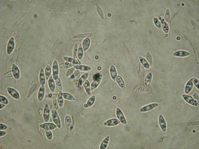 Phomopsis Konidioma eustromatické, hnědé nebo tmavě hnědé, konidiofory větvené, septované, konidiogenní buňky fialidické, septované,