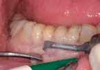 # Kompletní praktický kurz MODERNÍ ULTRAZVUKOVÉ TECHNOLOGIE A JEJICH VYUŽITÍ V PARODONTOLOGII, PROTETICE, CHIRURGII, ENDODONCII A DENTÁLNÍ HYGIENĚ Praktický kurz: Moderní parodontologie, vysoce