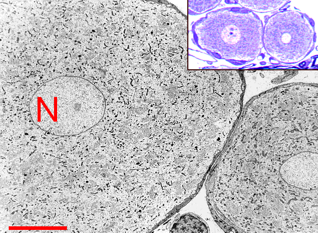 Unipolární neurony z ganglion trigeminale: N - jádro.