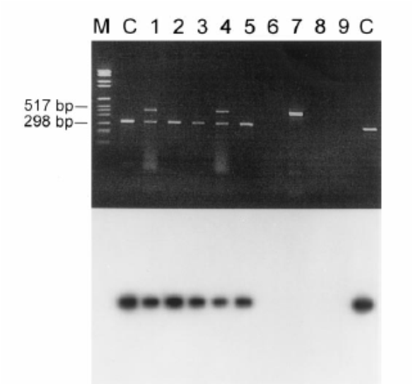1) histologie a imunohistologie (detekce zánětlivé infiltrace, zvýšená exprese HLA DR) Hodnocení EMB na našem pracovišti > 14 leukocytů/mm2 a/nebo > 7 T-lymfocytů/mm2 2) molekulárně-genetické vyš.