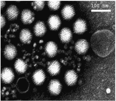 Epidemiologie u 40-50% pts s chronickou DKMP byly nalezeny v EMB imunohistologické zn. myokarditidy ve 25-40% nalezen virový genom Cooper LT. The heat is off. Immunosupresion for myocaditis revisited.