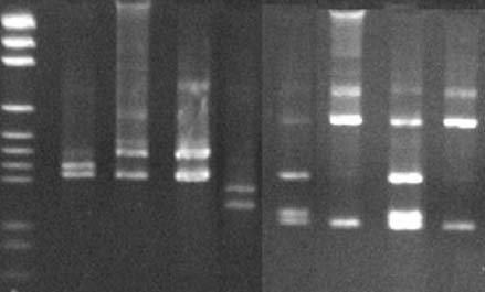 Obr 1: RFLP analýza fu5/ru3 PCR produktu RsaI rozlišuje ESFY -- AP a PD -- AY SfeI rozlišuje AP a AY -- ESFY a PD 2654 RsaI SfeI 1198 676 460 222 M ESFY AP PD AY ESFY