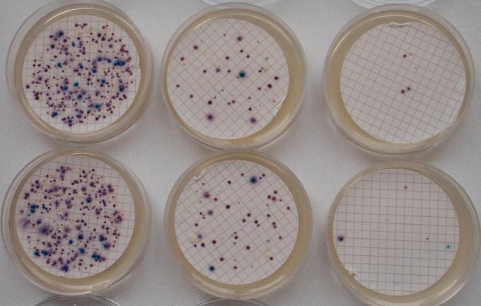 ČSN EN ISO 9308-1 Postupně se zavedlo do praxe laboratoří Dobré výsledky v ZZ Zatím není ohlas z IS PiVO (potenciální zhoršení kvality pitné vody v ukazateli koliformní bakterie?