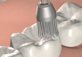 3M ESPE si udrïuje uznávané vedoucí postavení v oblasti inovace dentálních v robkû.
