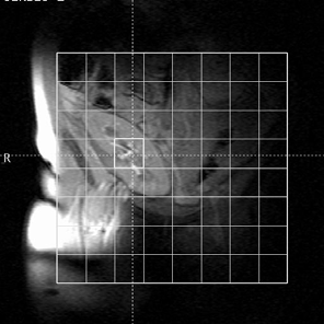 Tabulka 1: Výsledky biochemických a klinických testů pacientů (průměr a směrodatná odchylka).