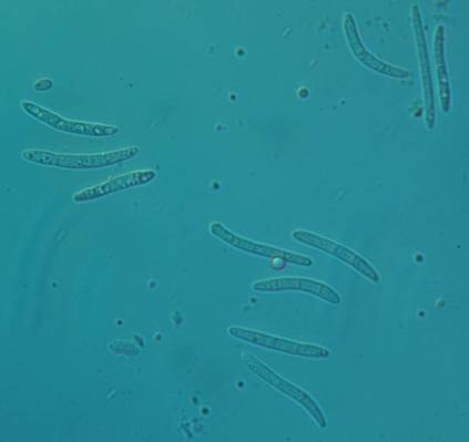Dothistroma septosporum konidie jsou dlouze vláknité, s 1 5
