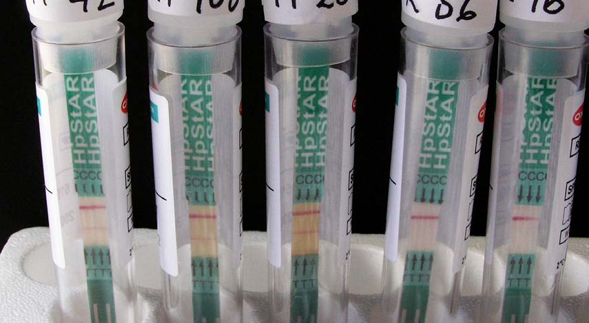 Obrázek 3 Test RAPID Hp StAR nádobky s rozpuštěnými vzorky a