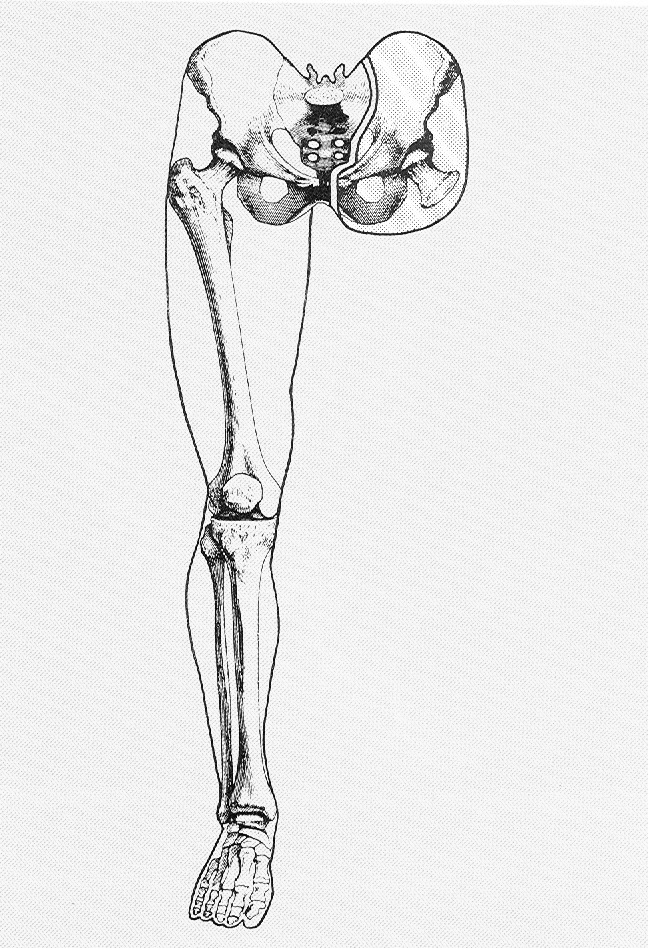 Hemipelvectomie (Hemipelvectomia) málo častý způsob amputace zasahující nad oblast pánve.