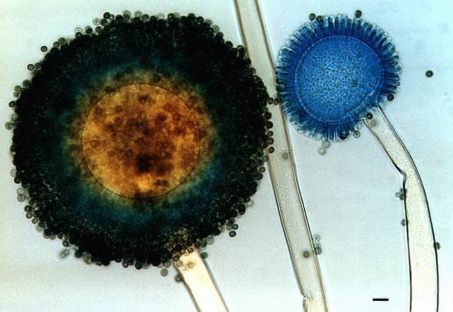 Pododdělení: PEZIZOMYCOTINA Třída: EUROTIOMYCETES Řád: EUROTIALES Penicillium - štětičkovec Houby charakteristické štětičkovitým konidioforem, větvícím se ve větve, metuly a nakonec fialidy -