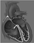 Srdce a atherosklerosa Energetický metabolismus vysoce aerobní (35% objemu svalu zaujímají mitochondrie) hlavní zdroj volné mastné kyseliny významný glukosa, laktát v malém množství ketonové látky,