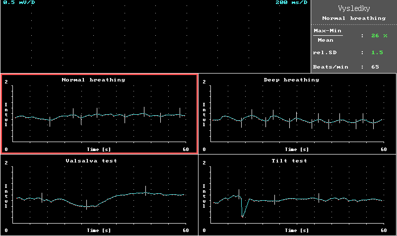 SNTV u DPNP: Metodika Elektrofyziologické a