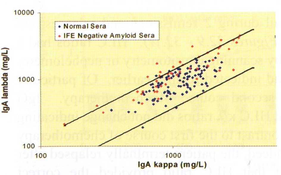 AL AMYLOIDÓZA IgA IgA IFE neg. IFE pos. IgA Hevylite vyšetření v souboru 118 normálních sér a 16 nemocných s AL-amyloidózou, s přítomností IgA MIg 14/16 (87%) mělo abnormální hodnoty Bradwell, R. A., 2008 Bradwell, R.
