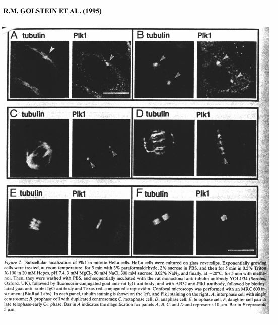 32 popřípadě aktivitu Plk k ošetření nádorových buněk v rámci protinádorové terapie (Elez et al. 2000). 1.19.
