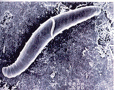 roupice (Enchytraeidae) Délka 1-2 mm Výskyt a nároky na prostředí povrchové vrstvy do 20 cm, hnízdovitá distribuce, citlivost na vysychání, snáší nízké ph (v
