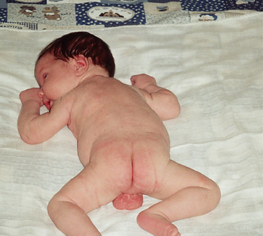 obr.5.1 leh na zádech (od narození do 4.týdne věku) postavení a nezvládá pohyb rukou před obličej v sagitální rovině.